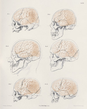 Lot 316, Auction  111, Froriep, August, Zur Kenntniss der Lagebeziehungen zwischen Großhirn und Schädeldach