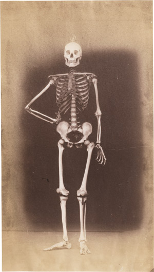 Lot 6412, Auction  111, Anonym, Menschliches Skelett in Pose