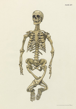 Lot 1558, Auction  120, Barbour, Alexander Hugh Freeland, Spinal deformity in relation to obstetrics