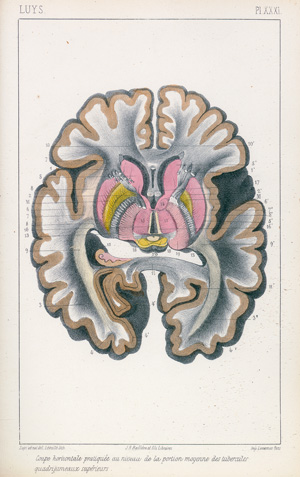 Lot 221, Auction  121, Luys, Jules Bernard, Recherches sur le système nerveux cérébro-spinal sa structure