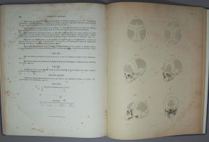 Los 329 - Welcker, Hermann - Untersuchungen über Wachsthum und Bau des menschlichen Schädels. Leipzig, Engelmann, 1862 - 6 - thumb