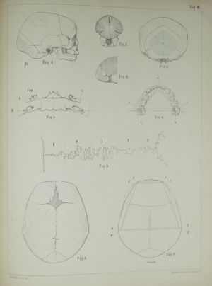 Los 329 - Welcker, Hermann - Untersuchungen über Wachsthum und Bau des menschlichen Schädels. Leipzig, Engelmann, 1862 - 8 - thumb