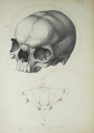 Los 329 - Welcker, Hermann - Untersuchungen über Wachsthum und Bau des menschlichen Schädels. Leipzig, Engelmann, 1862 - 10 - thumb