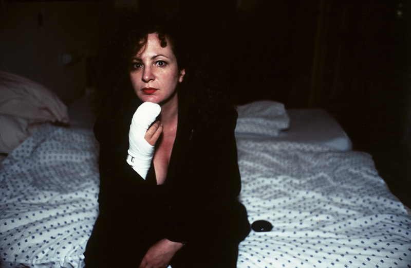 Lot 4176, Auction 127, Goldin, Nan, Self-portrait after Finger Operation, Berlin