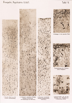 Lot 224, Auction  128, Kraepelin, Emil, Psychiatrie. Ein Lehrbuch für Studierende und Ärzte