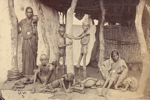 Los 4052 - India - Famine victims, Madras - 1 - thumb