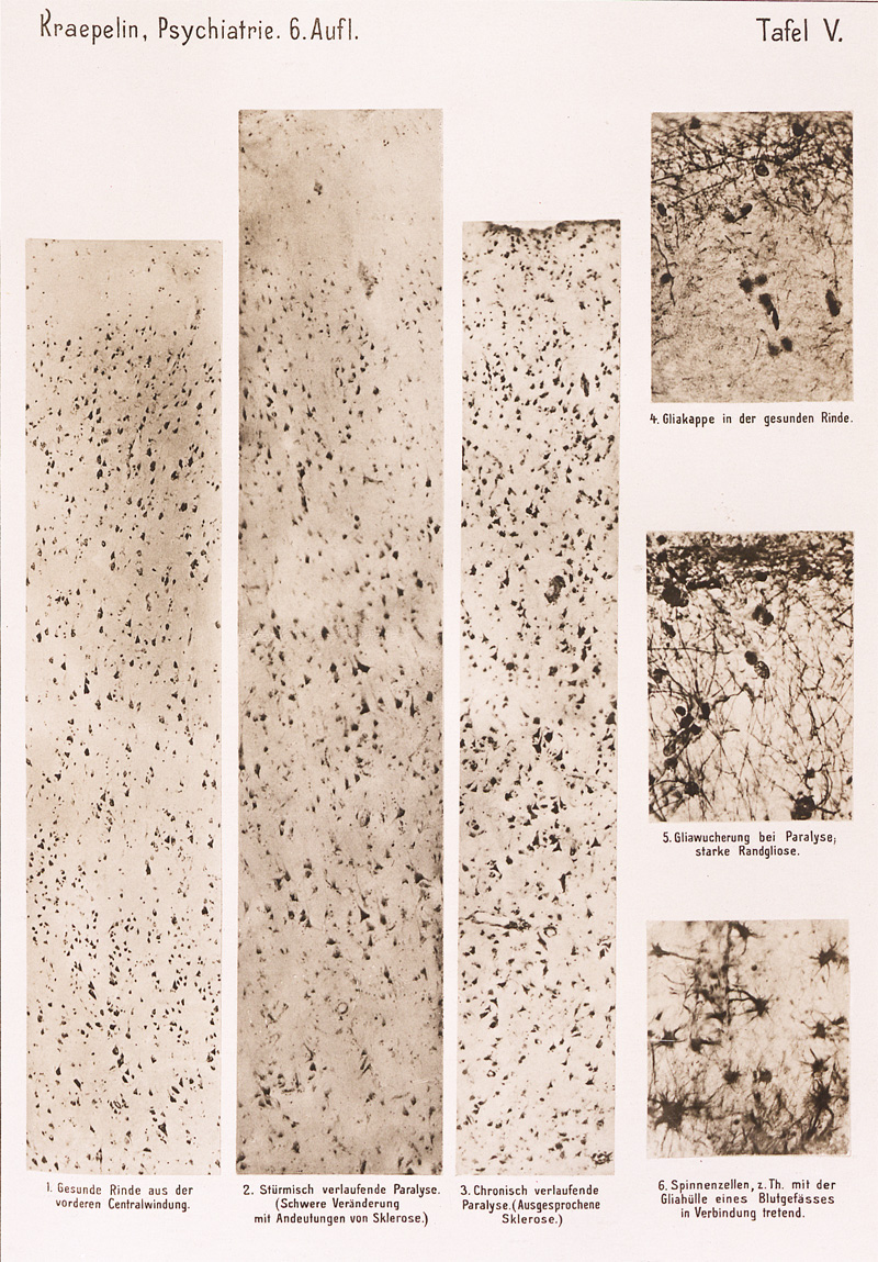 Lot 224, Auction 128, Kraepelin, Emil, Psychiatrie. Ein Lehrbuch für Studierende und Ärzte
